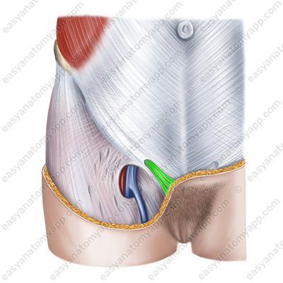 Round ligament of uterus (lig. teres uteri)